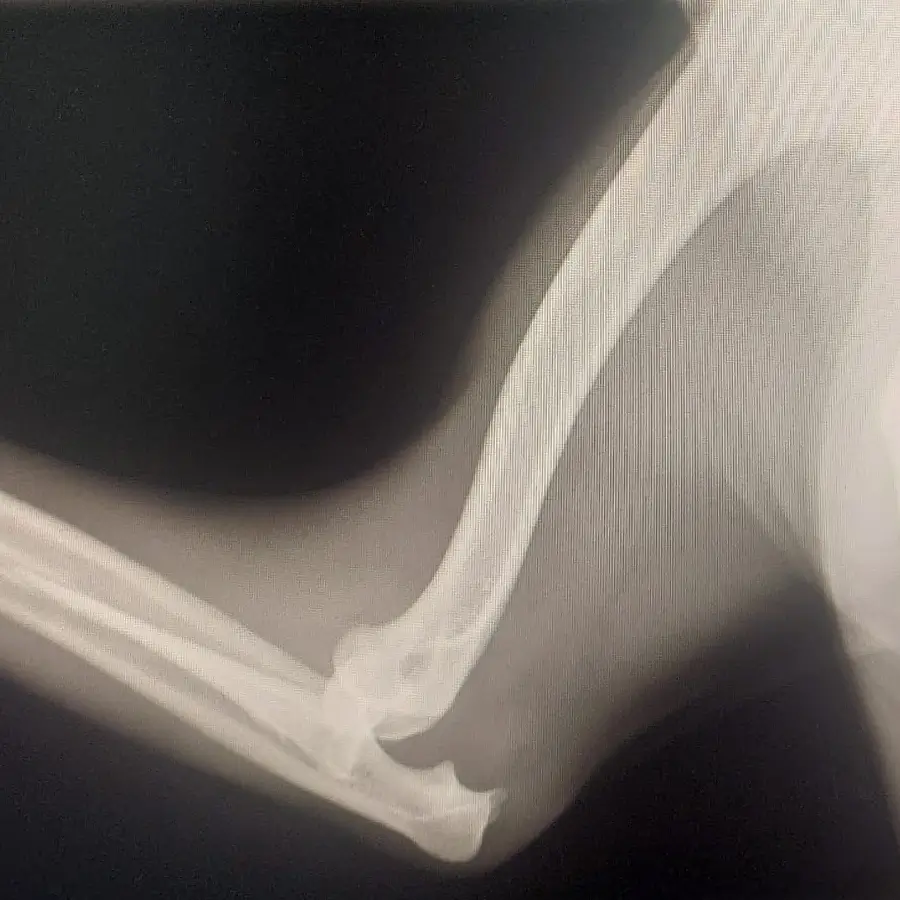 shango-diagnostico-radiologia-veterinaria X-ray of a dog's limb displayed on screen for veterinary diagnosis